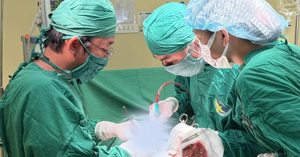 Calculi renali coraliformi: un caz complex